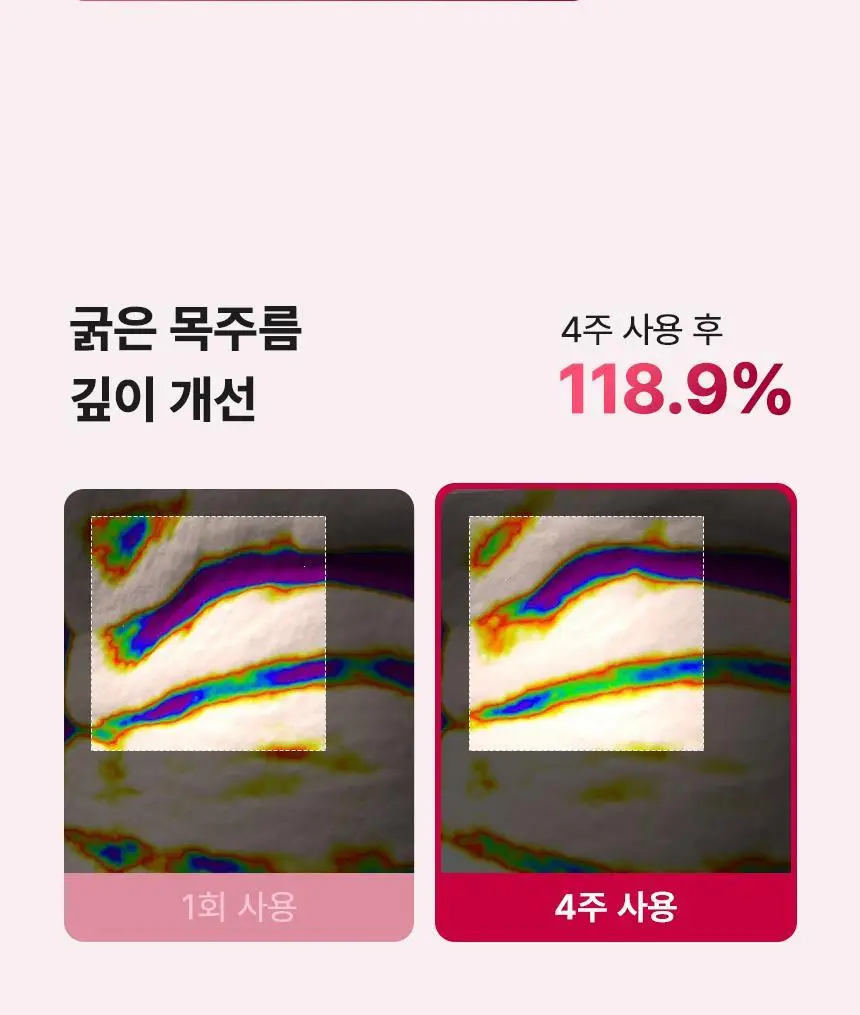 [줄기세포 넥패치/목주름] 뷰앤디 넥실키 마스크 (1매입/5매입) 상세페이지 23